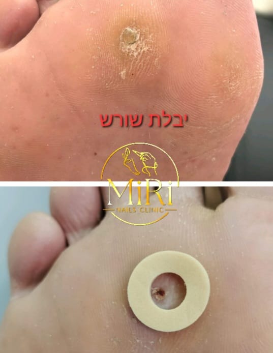 תוצאת טיפול בקליניקה — לפני ואחרי
